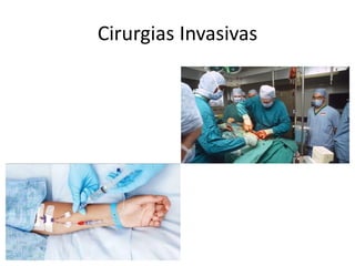 Cirurgias Invasivas
 