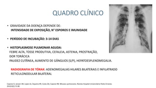 QUADRO CLÍNICO
• GRAVIDADE DA DOENÇA DEPENDE DE:
INTENSIDADE DE EXPOSIÇÃO, N° ESPOROS E IMUNIDADE
• PERÍODO DE INCUBAÇÃO: 3-14 DIAS
• HISTOPLASMOSE PULMONAR AGUDA:
FEBRE ALTA, TOSSE PRODUTIVA, CEFALEIA, ASTENIA, PROSTRAÇÃO,
DOR TORÁCICA
PALIDEZ CUTÂNEA, AUMENTO DE GÂNGLIOS (S/P), HEPATOESPLENOMEGALIA.
RADIOGRAFIA DE TÓRAX: ADENOMEGALIAS HILARES BILATERAIS E INFILATRADO
RETICULONODULAR BILATERAL
Capone D, Jansen JM, Lopes AJ, Siqueira HR, Costa AA, Capone RB. Micoses pulmonares. Revista Hospital Universitário Pedro Ernesto.
2010;9(2):72-80
 