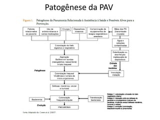 Patogênese da PAV
 