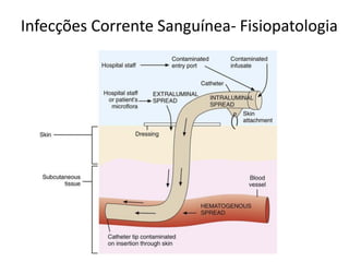 Infecções Corrente Sanguínea- Fisiopatologia
 