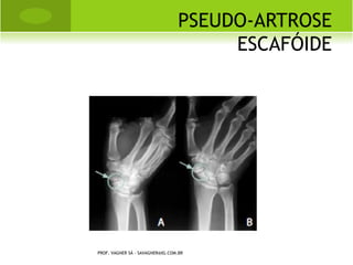 S USPENSÓRIO PAVLIK




PROF. VAGNER SÁ - SAVAGNER@IG.COM.BR
 