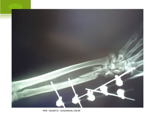 A LMOFADA F REJKA




PROF. VAGNER SÁ - SAVAGNER@IG.COM.BR
 