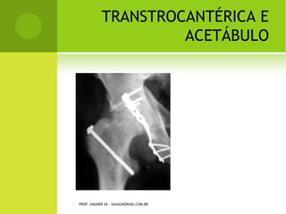 C OXA VARA C ONGÊNITA




PROF. VAGNER SÁ - SAVAGNER@IG.COM.BR
 