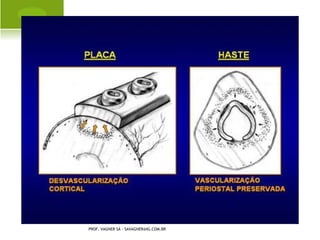 G ENO VARO F ISIOLÓGICO




PROF. VAGNER SÁ - SAVAGNER@IG.COM.BR
 