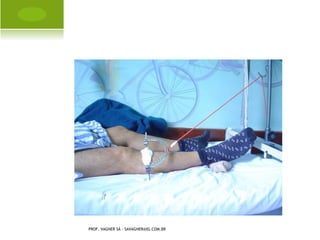 G ENO VARO U NILATERAL




PROF. VAGNER SÁ - SAVAGNER@IG.COM.BR
 