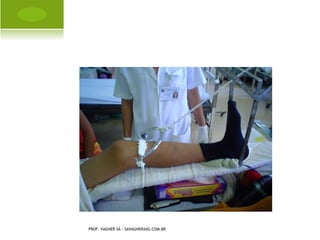 P É E QUINOVARO




PROF. VAGNER SÁ - SAVAGNER@IG.COM.BR
 