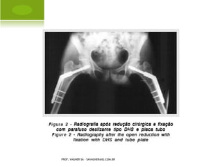 T ÁLUS I NVERTIDO




PROF. VAGNER SÁ - SAVAGNER@IG.COM.BR
 