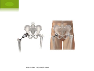 S INDACTILIA P É




PROF. VAGNER SÁ - SAVAGNER@IG.COM.BR
 