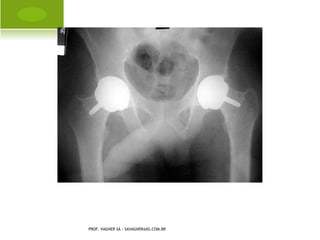 D ISTÚRBIOS METABÓLICOS




PROF. VAGNER SÁ -
SAVAGNER@IG.COM.BR
 