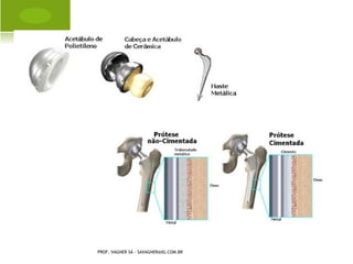 R AQUITISMO




PROF. VAGNER SÁ - SAVAGNER@IG.COM.BR
 