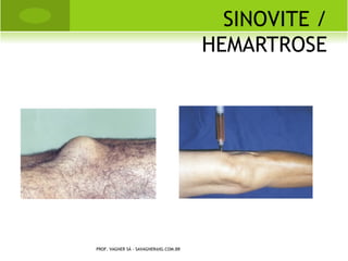 I MPORTANTE !!

   A vitamina D é fundamental para a absorção do
    cálcio pelo seu organismo. Deve ser consumido
    sempre em quantidades adequadas, evitando faltas
    e excessos.
   A quantidade de vitamina D que um adulto precisa
    varia, de acordo com a idade, de 5mg a 10mg,
    chegando a 15mg em idosos com mais de 70 anos.
   A exposição ao sol é importante para a obtenção de
    vitamina D, mas alguns alimentos também
    representam uma fonte desta vitamina.
              PROF. VAGNER SÁ - SAVAGNER@IG.COM.BR
 