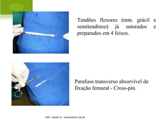 R AQUITISMO PUNHO




PROF. VAGNER SÁ - SAVAGNER@IG.COM.BR
 