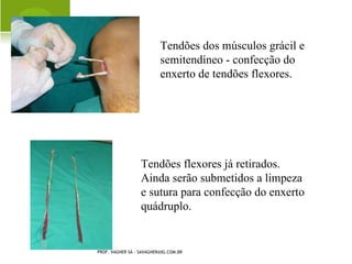 R AQUITISMO N UTRICIONAL




PROF. VAGNER SÁ - SAVAGNER@IG.COM.BR
 