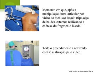 FATORES DE RISCO PARA A
               OSTEOPOROSE


     História familiar
     Raça branca
     Escoliose
     Osteogênese imperfeita
     Menopausa precoce
     Alcoolismo
     Tabagismo
PROF. VAGNER SÁ - SAVAGNER@IG.COM.BR
 