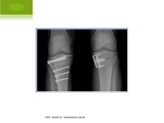 PROF. VAGNER SÁ - SAVAGNER@IG.COM.BR
 