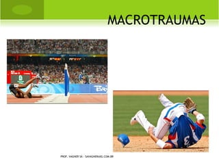 MACROTRAUMAS




PROF. VAGNER SÁ - SAVAGNER@IG.COM.BR
 