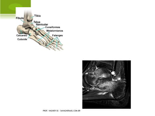 PROF. VAGNER SÁ - SAVAGNER@IG.COM.BR
 