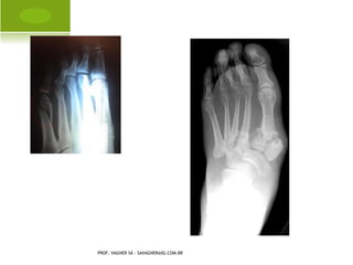 PROF. VAGNER SÁ - SAVAGNER@IG.COM.BR
 