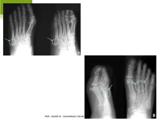 A RTRITE SÉPTICA




PROF. VAGNER SÁ - SAVAGNER@IG.COM.BR
 