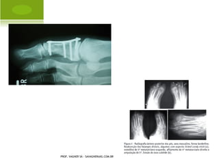 A RTRITE S ÉPTICA




PROF. VAGNER SÁ - SAVAGNER@IG.COM.BR
 