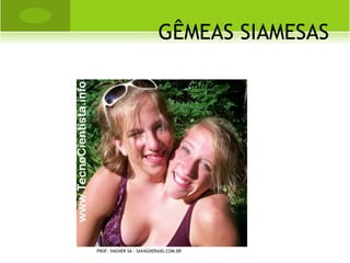 O STEOARTRITE - ARTROSE


       Doença degenerativa, em geral
        articular, que ocorre sobretudo em
        pessoas idosas e do sexo feminino.
        O elemento fundamentalmente
        lesado é a cartilagem articular, que
        apresenta fenotípica e
        genotipicamente uma fragilidade, a
        qual predispõe o processo artrósico.
PROF. VAGNER SÁ - SAVAGNER@IG.COM.BR
 