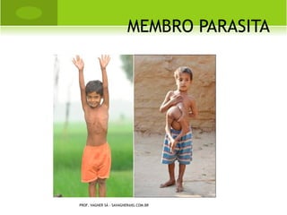 CLASSIFICAÇÃO

   Primária.    Quando     o    processo
    degenerativo    ocorre     com      o
    envelhecimento ou com o uso excessivo
    das articulações ou ainda pela
    concomitância       destas       duas
    eventualidades.
   Secundária. Quando em decorrência de
    uma patologia pré-existente, que ao
    acometer a articulação ou a região peri-
    articular predispõe a degeneração
    articular.                  PROF. VAGNER SÁ - SAVAGNER@IG.COM.BR
 