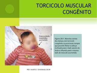 A RTROPLASTIA PARCIAL




PROF. VAGNER SÁ - SAVAGNER@IG.COM.BR
 