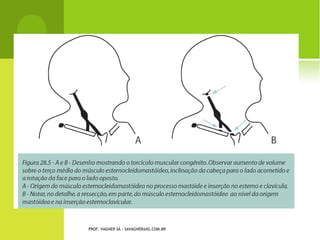 A RTROPLASTIA TOTAL




PROF. VAGNER SÁ - SAVAGNER@IG.COM.BR
 