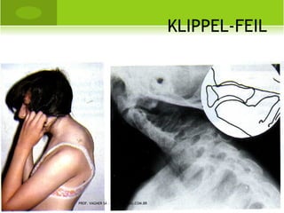 A RTROPLASTIA TOTAL




PROF. VAGNER SÁ - SAVAGNER@IG.COM.BR
 