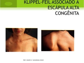 D ISTÚRBIOS DAS E PÍFISES E DO
C RESCIMENTO E PIFISÁRIO




PROF. VAGNER SÁ -
SAVAGNER@IG.COM.BR
 