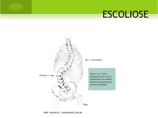 L EGG -P ERTHES -C ALVÈ




PROF. VAGNER SÁ - SAVAGNER@IG.COM.BR
 