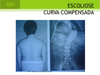 L EGG -P ERTHES -C ALVÈ




PROF. VAGNER SÁ - SAVAGNER@IG.COM.BR
 