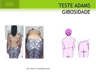 L EGG -P ERTHES -C ALVÈ




PROF. VAGNER SÁ - SAVAGNER@IG.COM.BR
 