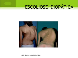 L EGG -P ERTHES -C ALVÈ




PROF. VAGNER SÁ - SAVAGNER@IG.COM.BR
 