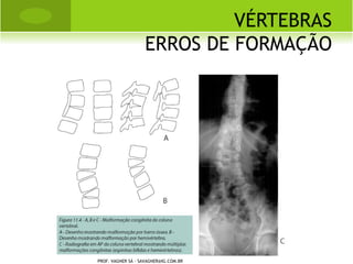 SÈVER




PROF. VAGNER SÁ - SAVAGNER@IG.COM.BR
 