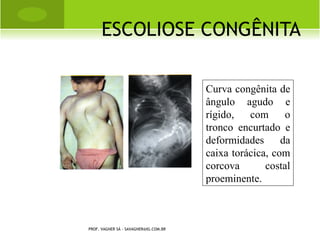 O SGOOD - SCHLATTER




PROF. VAGNER SÁ - SAVAGNER@IG.COM.BR
 