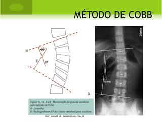 K IENBÖCK




PROF. VAGNER SÁ - SAVAGNER@IG.COM.BR
 