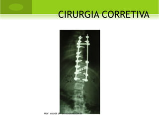 I MAGEM DE LACHAPELLE




PROF. VAGNER SÁ - SAVAGNER@IG.COM.BR
 