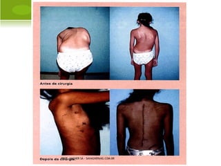 LACHAPELLE




PROF. VAGNER SÁ - SAVAGNER@IG.COM.BR
 