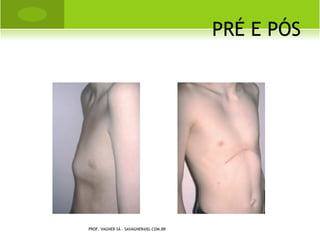 TRAUMATOLOGIA




PROF. VAGNER SÁ -
SAVAGNER@IG.COM.BR
 