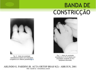 S ÍNFISE PÚBICA




PROF. VAGNER SÁ - SAVAGNER@IG.COM.BR
 