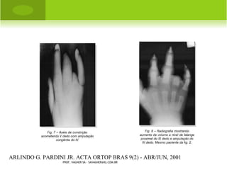 L UXAÇÃO DO Q UADRIL




PROF. VAGNER SÁ - SAVAGNER@IG.COM.BR
 