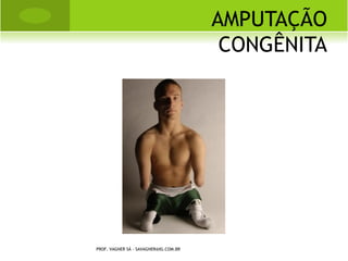 R EALINHAMENTO PATELAR




PROF. VAGNER SÁ - SAVAGNER@IG.COM.BR
 