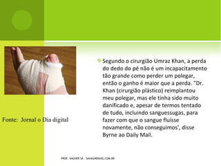        RUPTURA OU LACERAÇÃO ENTRE
        MÚSCULO E TENDÃO: Se a ruptura ou
        laceração é parcial, ocorre dor na região
        da fissura quando o músculo é alongado
        ou quando se contrai contra resistência.
        Se a ruptura ou laceração é completa, o
        músculo não traciona o local lesionado,
        de modo que alongamento ou contração
        do músculo não causa dor.


    PROF. VAGNER SÁ - SAVAGNER@IG.COM.BR
 