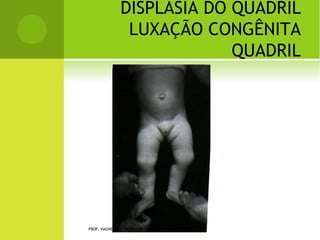 PROF. VAGNER SÁ - SAVAGNER@IG.COM.BR
 