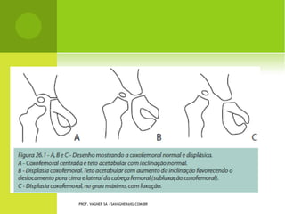 D E QUERVAIN
   Tendinite do abdutor longo e
    extensor curto do polegar.




                                                          Teste Finkelstein

                PROF. VAGNER SÁ - SAVAGNER@IG.COM.BR
 