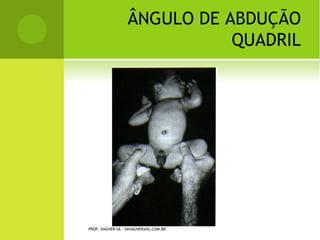 D EDO EM GATILHO




PROF. VAGNER SÁ - SAVAGNER@IG.COM.BR
 