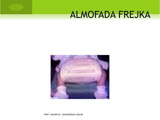 E NTESITE - EPICONDILITE


       Processo inflamatório que atinge os
        pontos de origem e inserção dos
        tendões. As entesites e as
        epicondilites freqüentemente são
        determinadas por movimentos
        repetitivos de tração. Elas também
        estão relacionadas a processos
        reumáticos.
PROF. VAGNER SÁ - SAVAGNER@IG.COM.BR
 