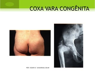 FASE INFLAMATÓRIA




PROF. VAGNER SÁ - SAVAGNER@IG.COM.BR
 