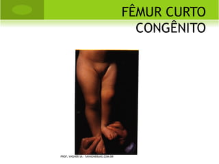 FASE REPARATIVA
                                          “CALO MOLE”




PROF. VAGNER SÁ - SAVAGNER@IG.COM.BR
 